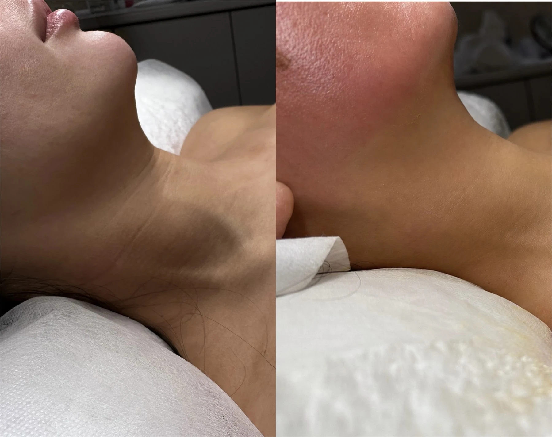 Side-by-side Saint Serene client result comparison