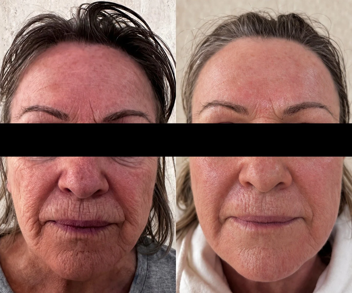 Side-by-side Saint Serene client result comparison