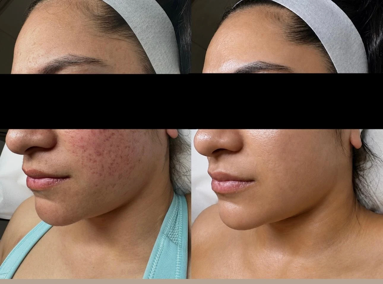 Side-by-side Saint Serene client result comparison