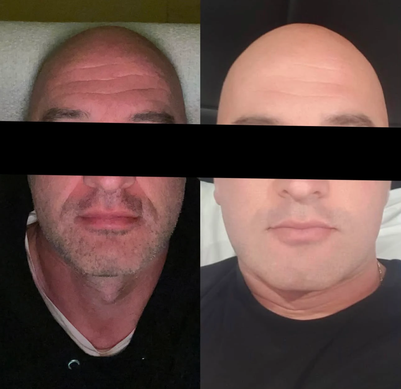 Side-by-side Saint Serene client result comparison