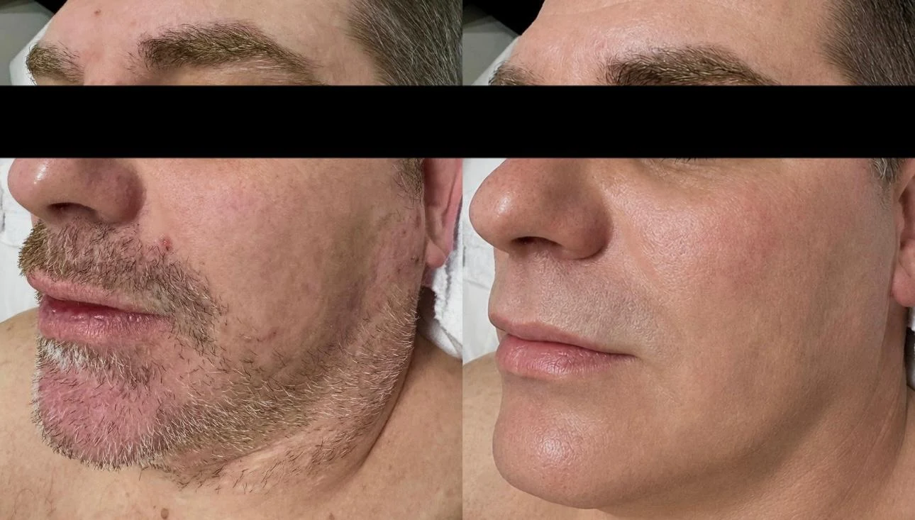 Side-by-side Saint Serene client result comparison