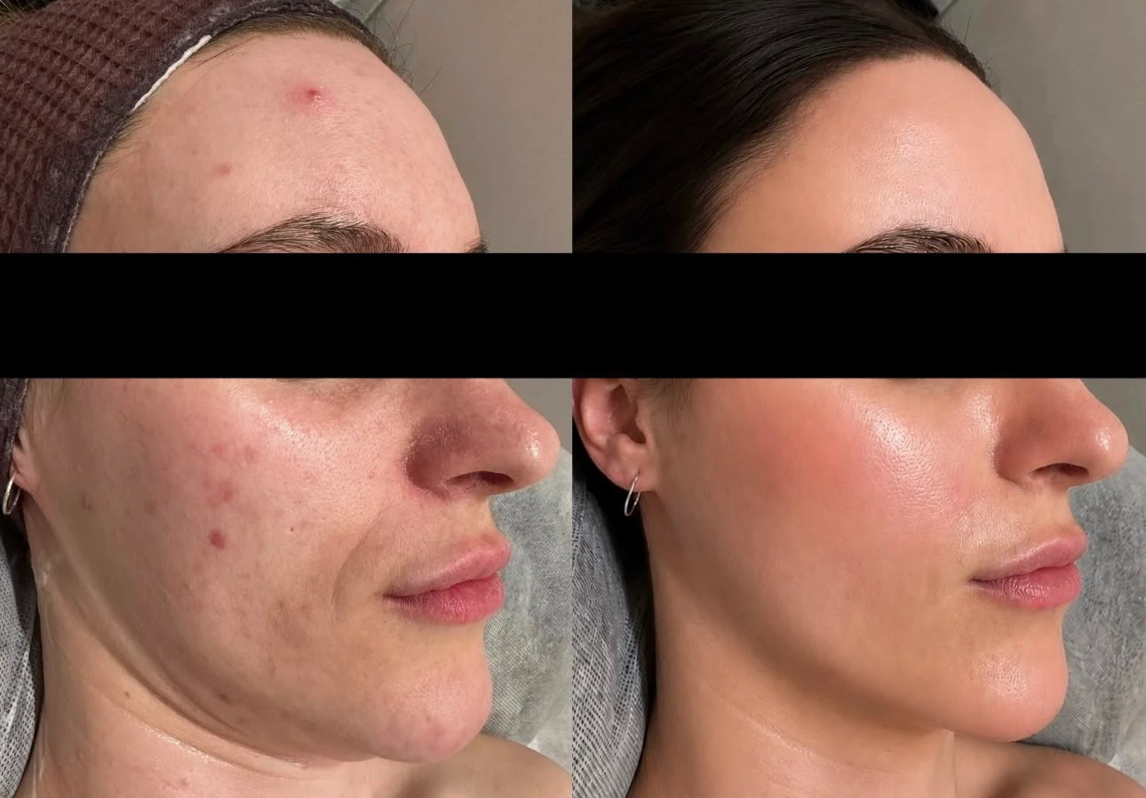 Side-by-side Saint Serene client result comparison